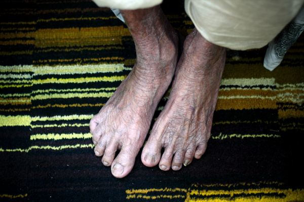 Podología para mayores: Cómo afecta el envejecimiento a los pies y su estructura